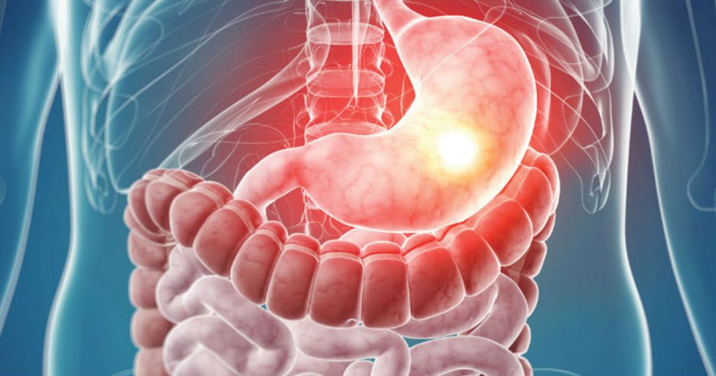 Wellhealthorganic.com : Key Signs of Gastroenteritis